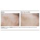 Депигментирующий гель без гидрохинона PCA Skin Pigment Gel HQ Free 29,5 мл - дополнительное фото