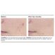 Гель для проблемной кожи PCA Skin Acne Gel 29.5 мл - дополнительное фото
