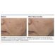 Крем для проблемної шкіри PCA Skin Acne Cream 14,2 г - додаткове фото
