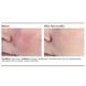 Сыворотка от покраснений PCA Skin Anti-Redness Serum - дополнительное фото