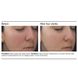 Успокаивающая сыворотка двойного действия PCA Skin Dual Action Redness Relief - дополнительное фото