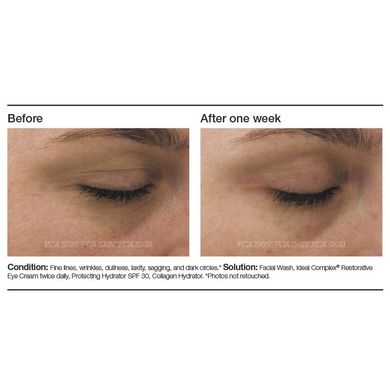 Восстанавливающий гель для глаз PCA Skin Ideal Complex Revitalizing Eye Gel 14,2 г - основное фото