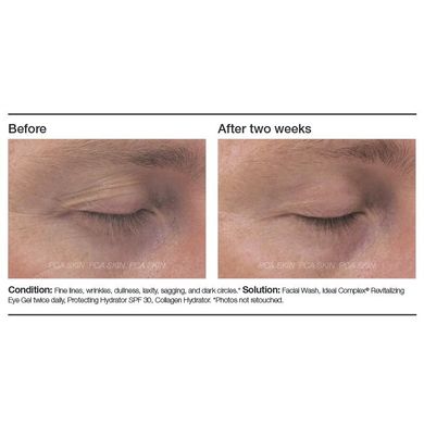 Зміцнювальний крем для очей PCA Skin Ideal Complex Restorative Eye Cream 14,2 г - основне фото