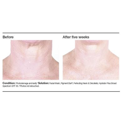 Крем для шеи и зоны декольте PCA Skin Perfecting Neck & Décolleté 85 г - основное фото