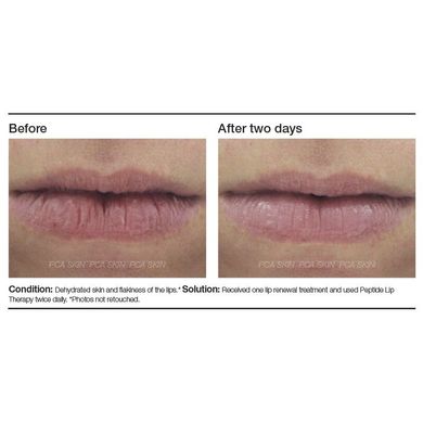 Пептидный бальзам для губ PCA Skin Peptide Lip Therapy 8 мл - основное фото