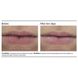 Пептидний бальзам для губ PCA Skin Peptide Lip Therapy 8 мл - додаткове фото
