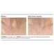 Мыло против пигментных пятен PCA Skin Pigment Bar 90 г - дополнительное фото