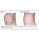 Лосьон для тела PCA Skin Body Therapy 198 мл - дополнительное фото
