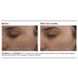 Інтенсивна сироватка проти акне з ретинолом 0.5% PCA Skin Intensive Clarity Treatment®: 0.5% Pure Retinol Night 29,5 мл - додаткове фото