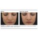 Интенсивная сыворотка против акне с ретинолом 0.5% PCA Skin Intensive Clarity Treatment®: 0.5% Pure Retinol Night 29,5 мл - дополнительное фото