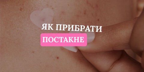 Банер 2